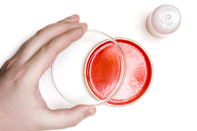 Why You Should Always Ask for a Urine Culture Before Taking Antibiotics for a UTI